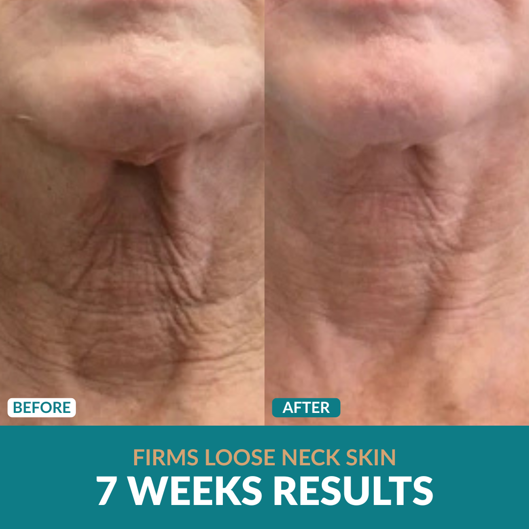 Anti-Cellulite Oil