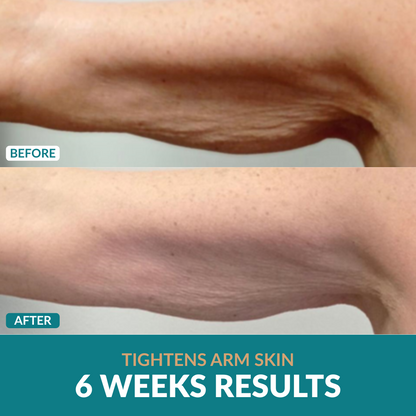 Anti-Cellulite Oil