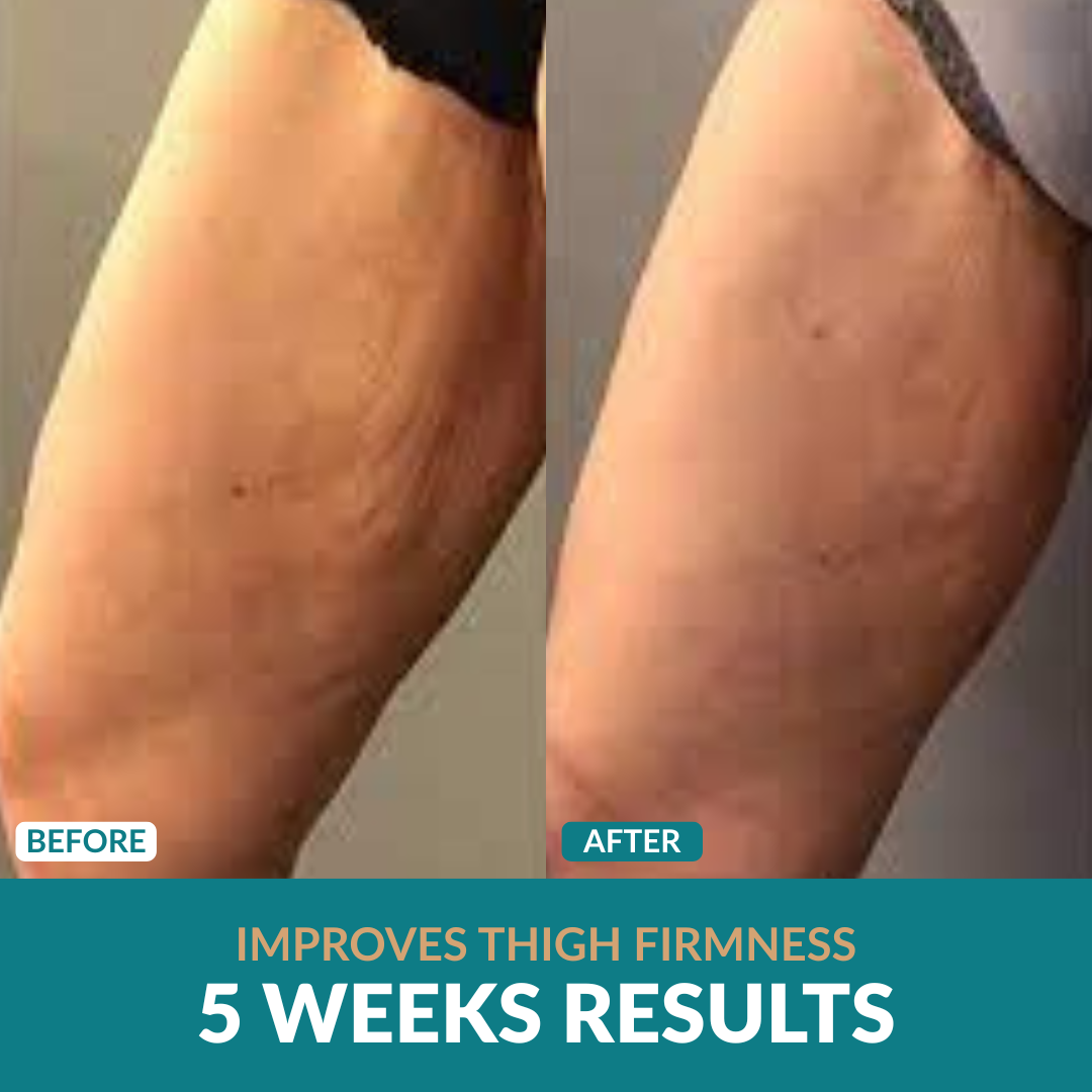 Anti-Cellulite Oil