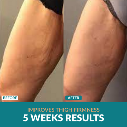 Anti-Cellulite Oil